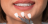 Restauração Dentária com Resina: Recupere o Sorriso Perfeito