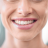 Clareamento Dental